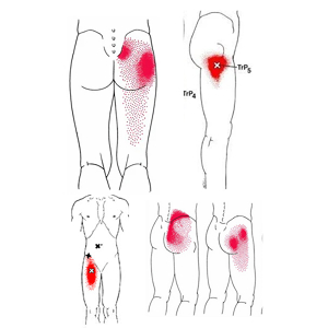 BOL U KUKU I PREPONI